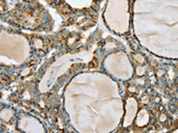 PHKB Antibody (PACO16862)