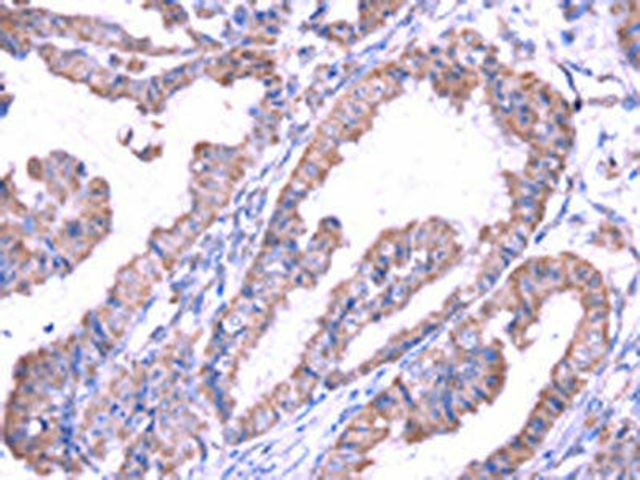 SRPK1 Antibody (PACO17097)