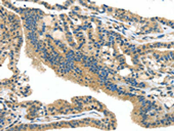 SMYD3 Antibody (PACO17116)