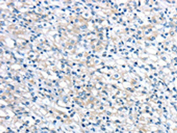 LEFTY2 Antibody (PACO17227)