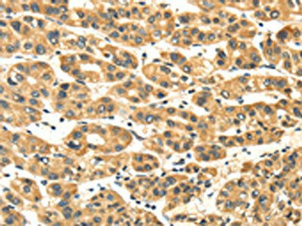 NME8 Antibody (PACO17341)