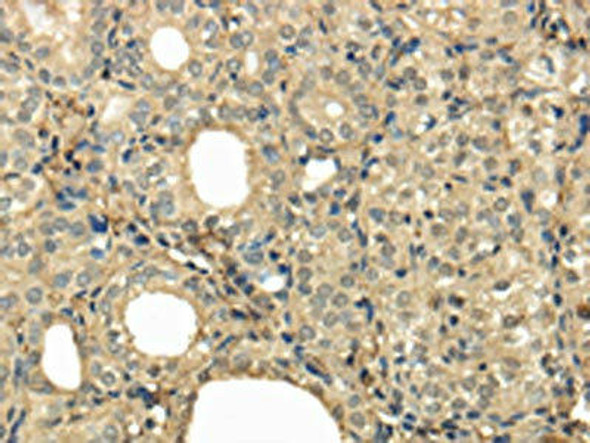 UBE2B Antibody (PACO17353)