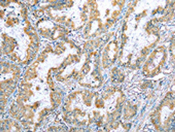 VAPA Antibody (PACO17411)