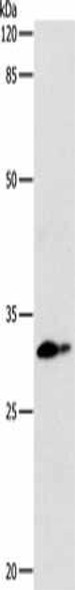 CEBPD Antibody (PACO17686)