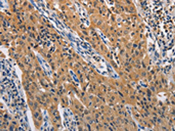 ADAMDEC1 Antibody (PACO15318)
