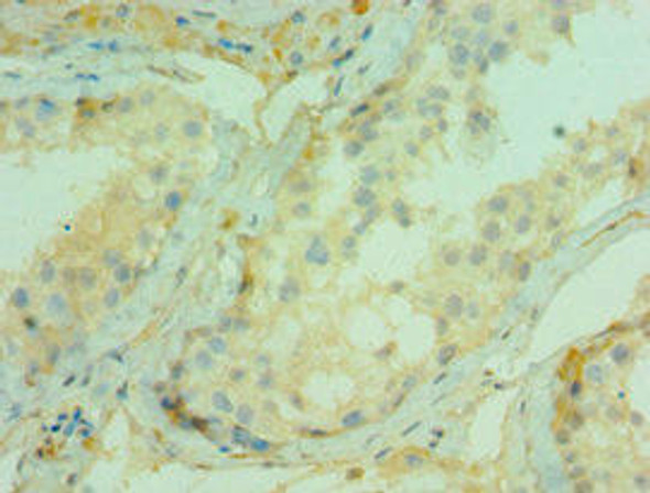 CDC5L Antibody (PACO43272)