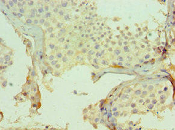 CMA1 Antibody (PACO43322)