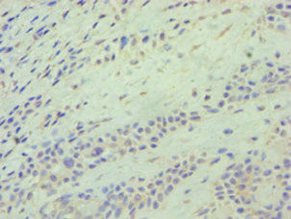 ATG9A Antibody (PACO43418)