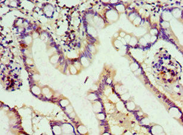 ALKBH2 Antibody (PACO43424)