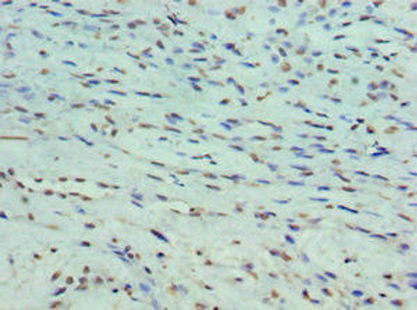 PPP1R1B Antibody (PACO43471)