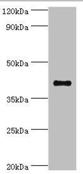 SULT2B1 Antibody (PACO43668)