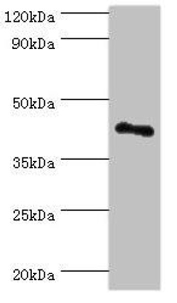 RSAD2 Antibody (PACO43876)