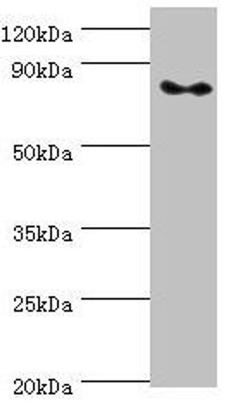 ATRIP Antibody (PACO44074)