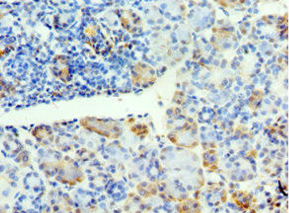 SYT4 Antibody (PACO44092)