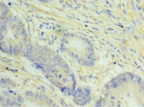 NCAPH Antibody (PACO44094)