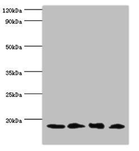 UBE2V2 Antibody (PACO44156)
