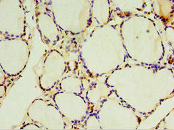 SULT1C2 Antibody (PACO44163)