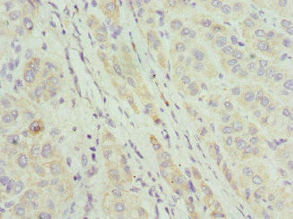 CIAPIN1 Antibody (PACO44234)