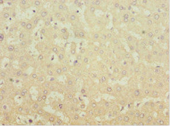 MGAT1 Antibody (PACO44267)