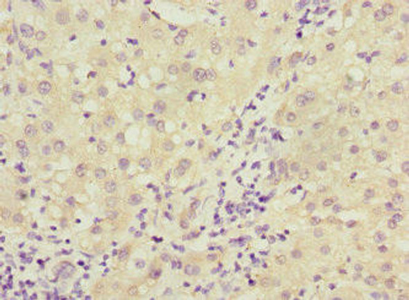 DCTD Antibody (PACO44476)