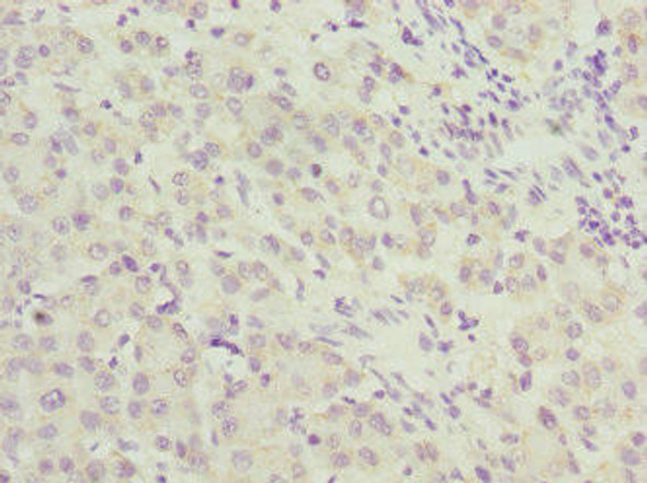 UPF2 Antibody (PACO44530)