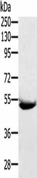 SERPING1 Antibody (PACO20446)