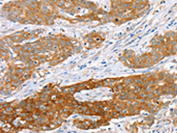 ABCC8 Antibody (PACO20625)