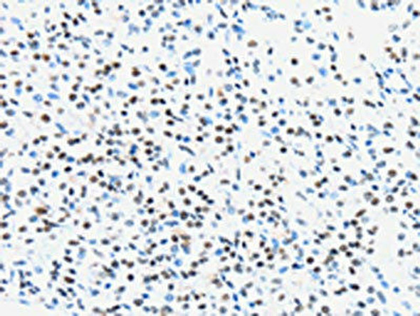 UBA1 Antibody (PACO20807)