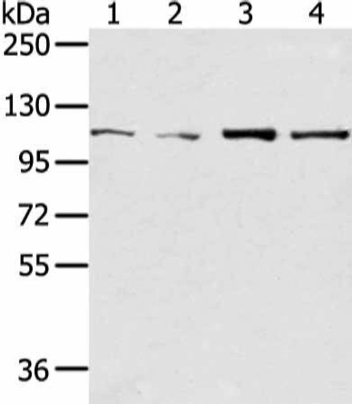 UBA1 Antibody (PACO20808)