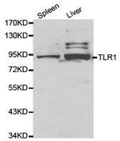 TLR1 Antibody (PACO21065)