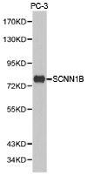 SCNN1B Antibody (PACO21197)