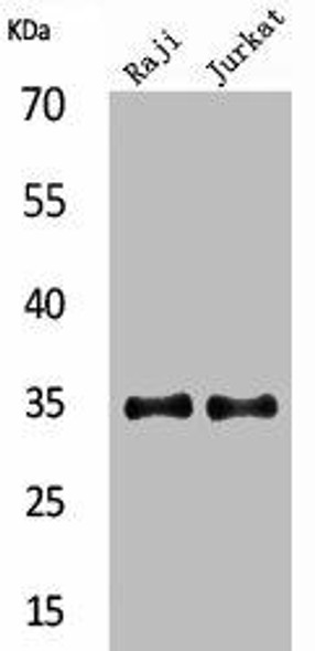 IL4 Antibody (PACO01859)