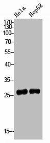 IGFBP3 Antibody (PACO02186)