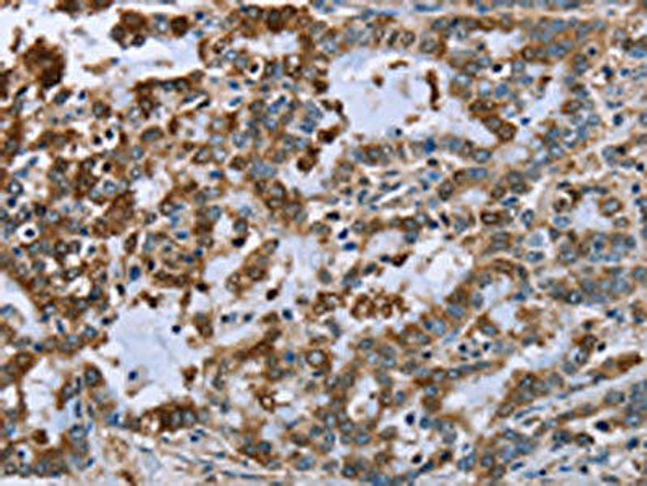 IMPDH2 Antibody (PACO16544)