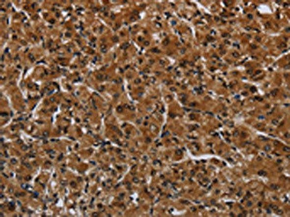 IRGM Antibody (PACO16557)