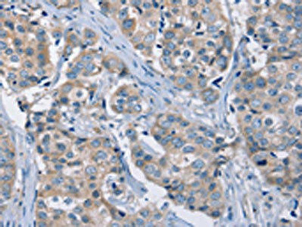 KCNQ5 Antibody (PACO16584)