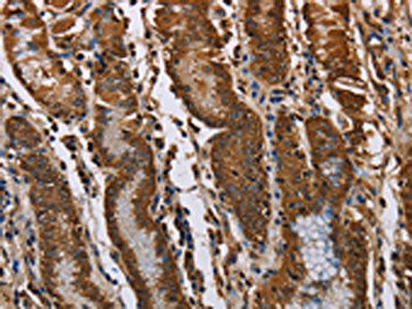 KIF2A Antibody (PACO16587)