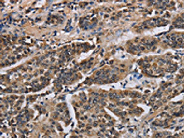 KIF2A Antibody (PACO16588)