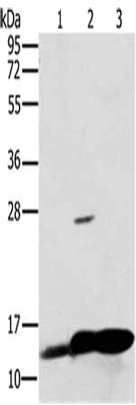 NDUFS5 Antibody (PACO16755)