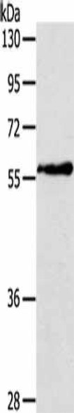 OLFM4 Antibody (PACO16813)