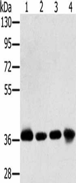 PDLIM1 Antibody (PACO16849)