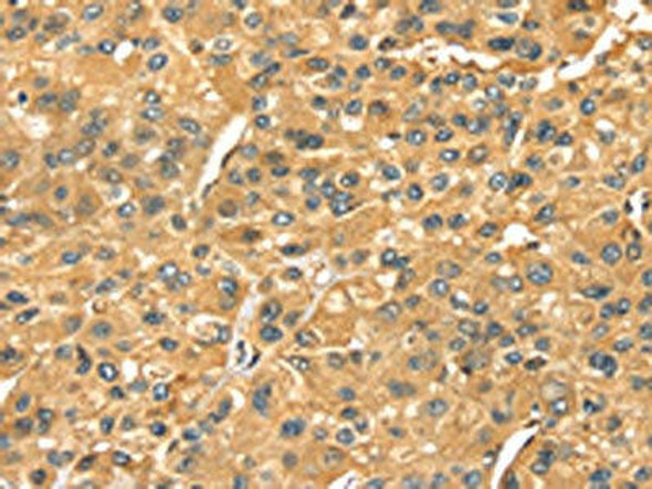 SERPINB6 Antibody (PACO17080)