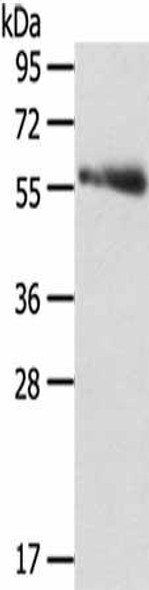 SRPK3 Antibody (PACO17170)