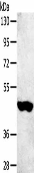SULT2B1 Antibody (PACO17177)