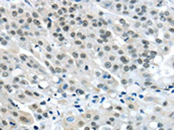 MED4 Antibody (PACO17306)