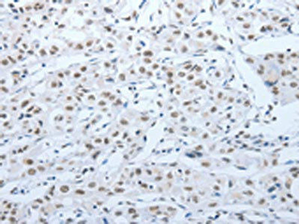 ACIN1 Antibody (PACO17485)