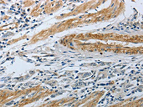 NPR1 Antibody (PACO17589)