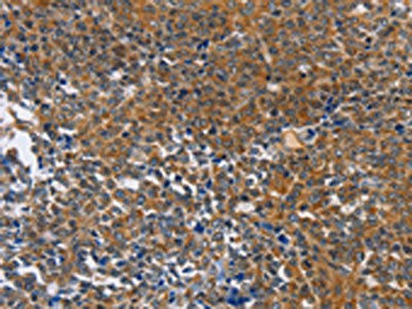 DPYSL4 Antibody (PACO17725)