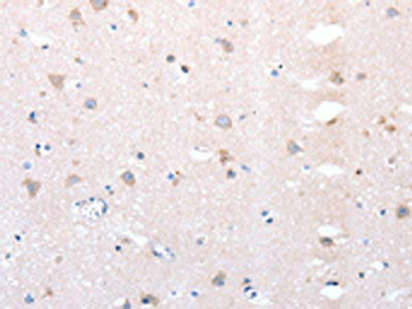 DTX1 Antibody (PACO17788)