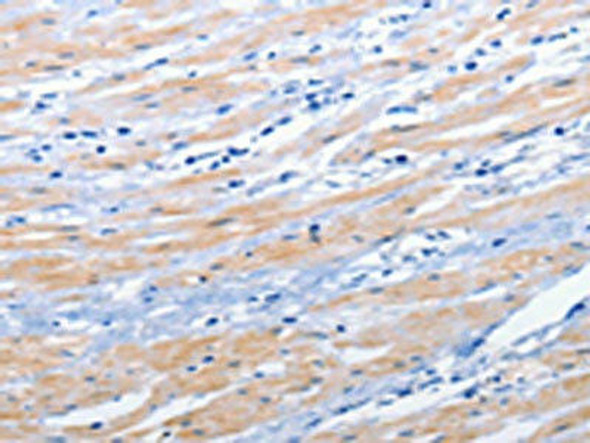 EPHA1 Antibody (PACO17837)